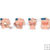 Sutien invizibil push up din silicon