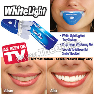 Aparat de albire a dintilor, White Light